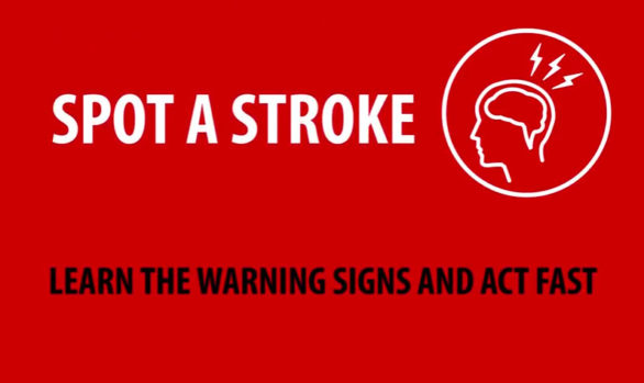 Stroke awareness motion infographic
